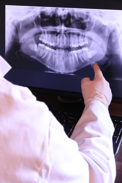 Best Emergency Tooth Extraction in St Simons, GA