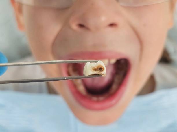 Best Emergency Treatment for Toothache in St Simons, GA